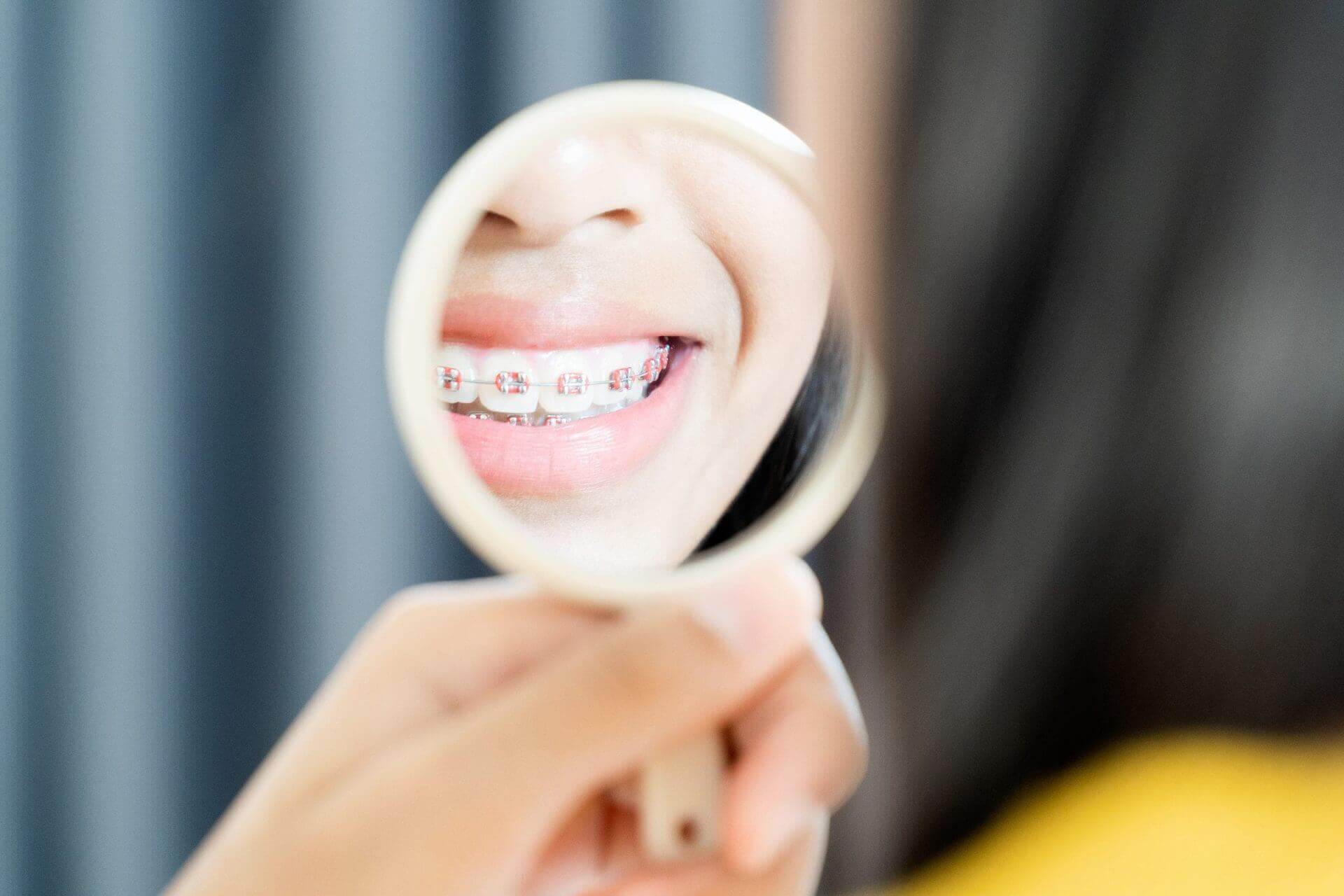 Can you have a beautiful smile without removing some of your teeth?