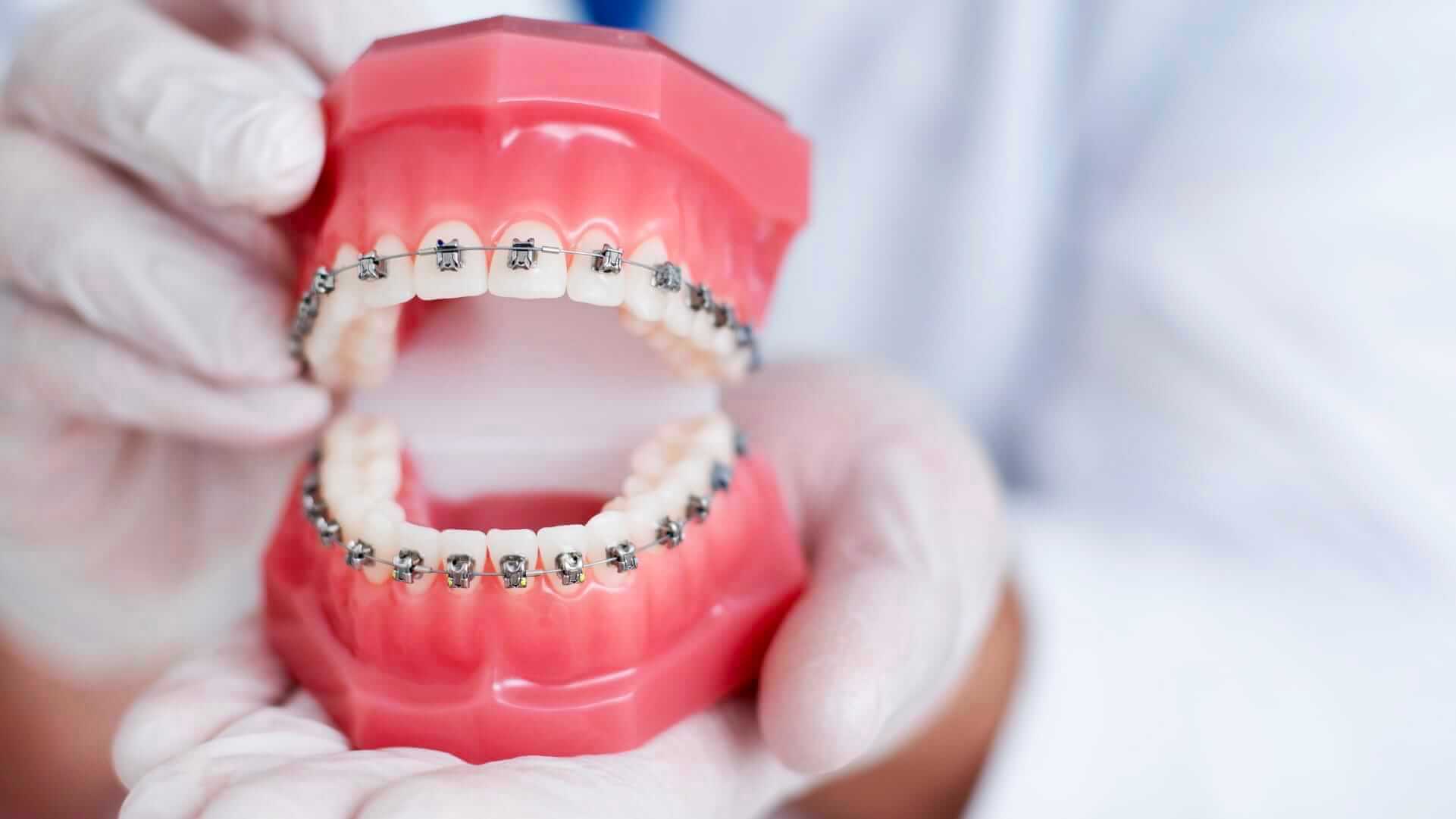 5 Surprising Facts About Orthodontics
