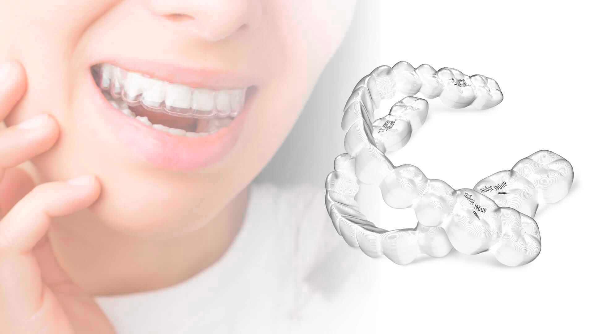Got some questions about Angel Aligner? We’ve got you covered!