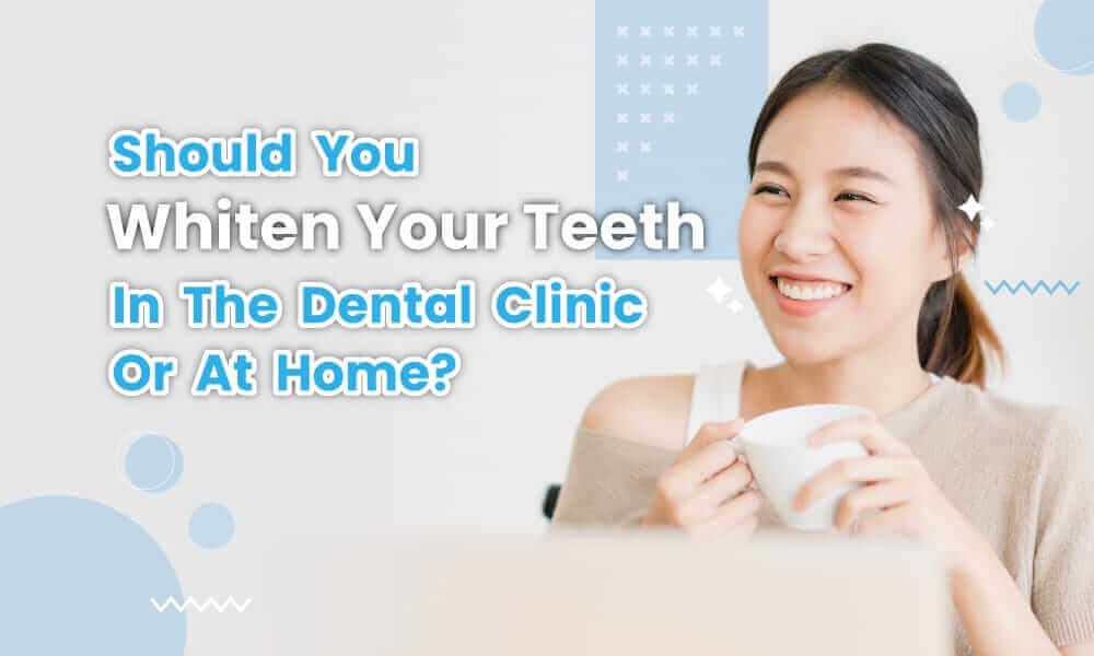 Should you whiten your teeth in the dental clinic or at home?